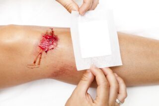 Photo d'une blessure au genou et d'un pansement