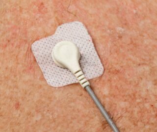 Image d'un électrode en non-tissé collé sur un patient